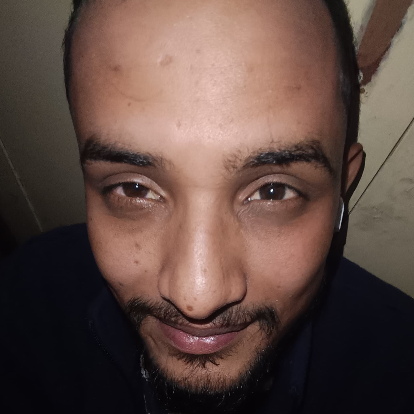 Shashank bhatt