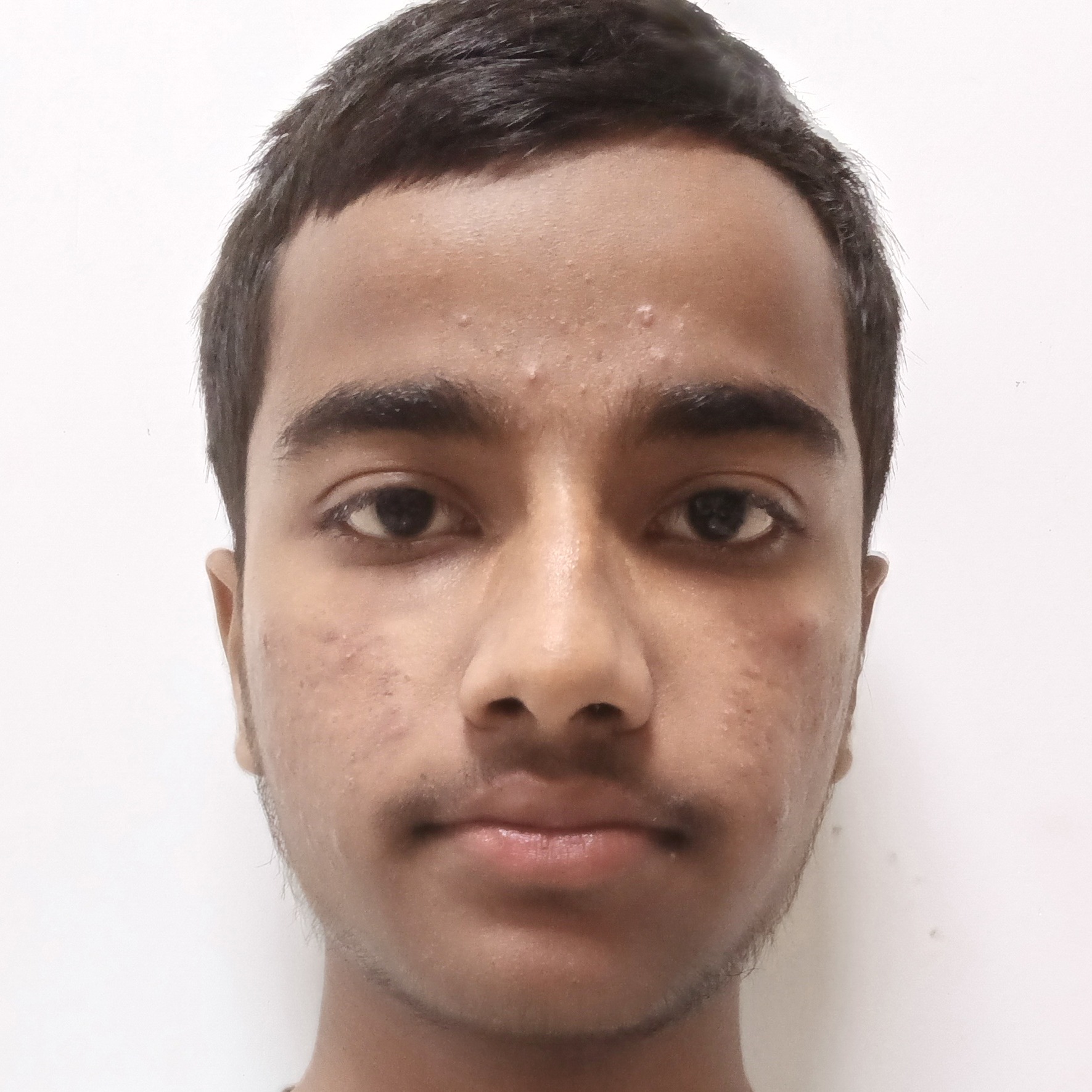 DEVENDRA KUMAR