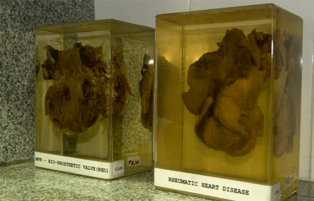 International Centre For CardioThoracic and Vascular Diseases Chennai Laboratories photo 12