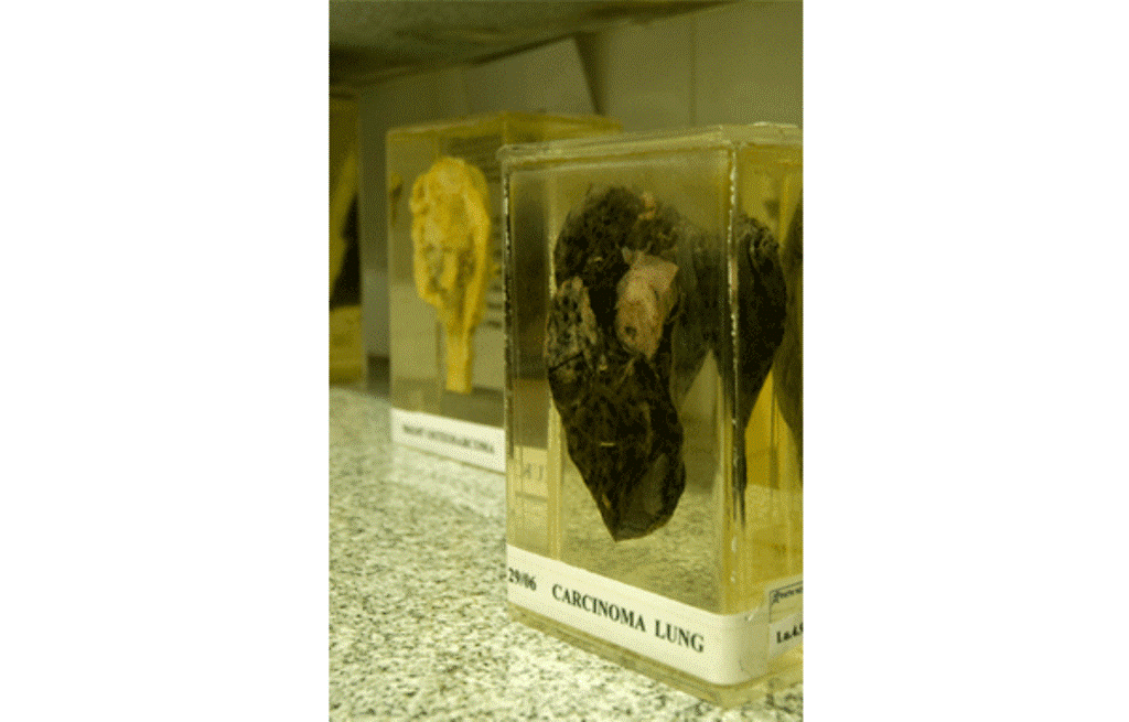 International Centre For CardioThoracic and Vascular Diseases Chennai Laboratories photo 13