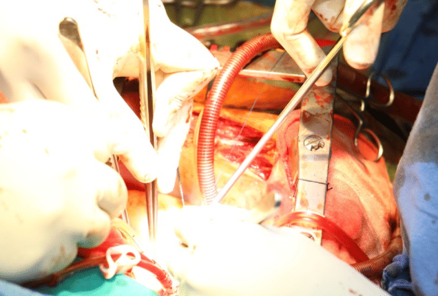 NIMS University Jaipur Hospital photo 9