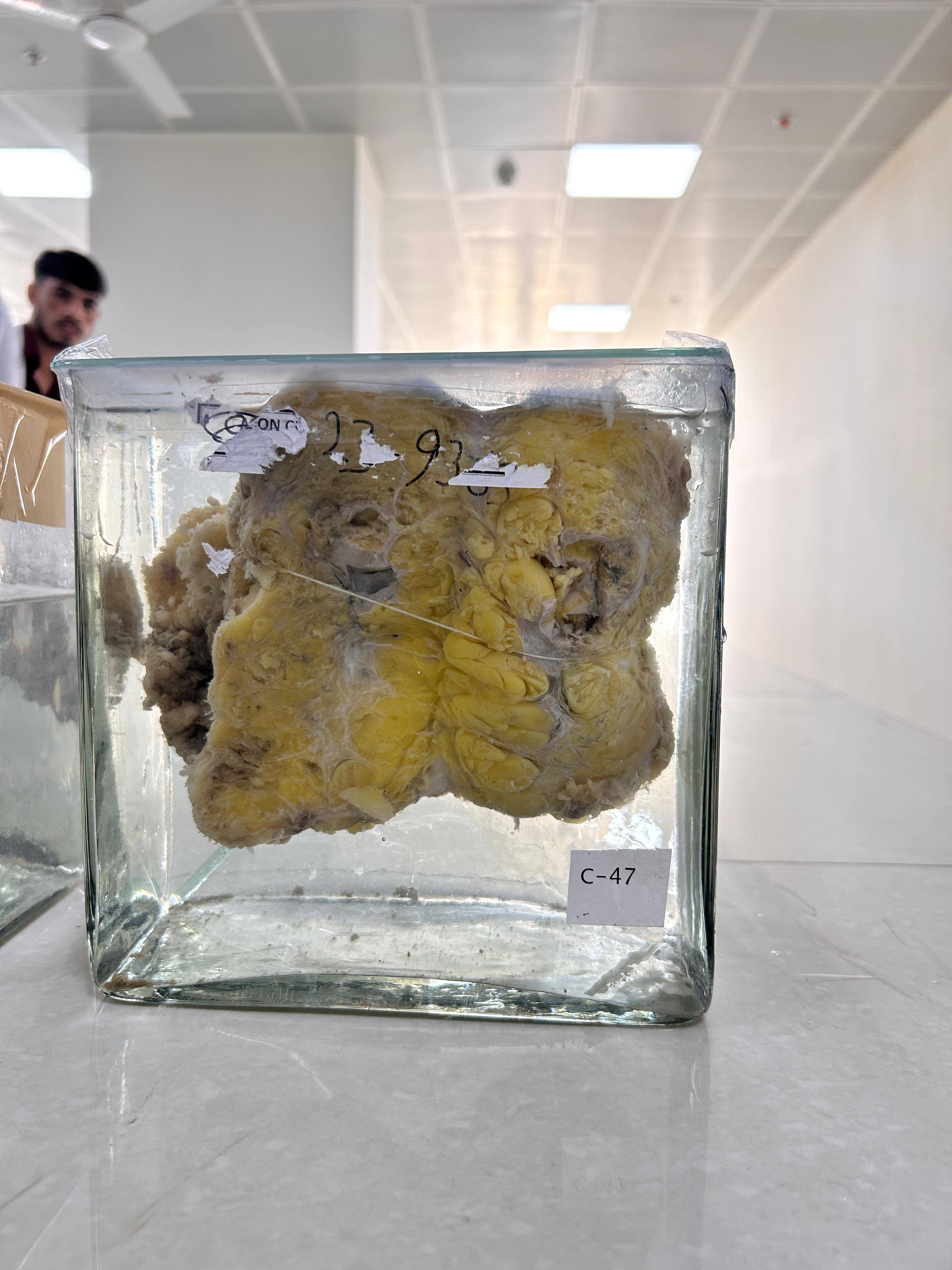 Autonomous State Medical College Firozabad Infrastructure & Academic Building photo (11) by Manas Gupta