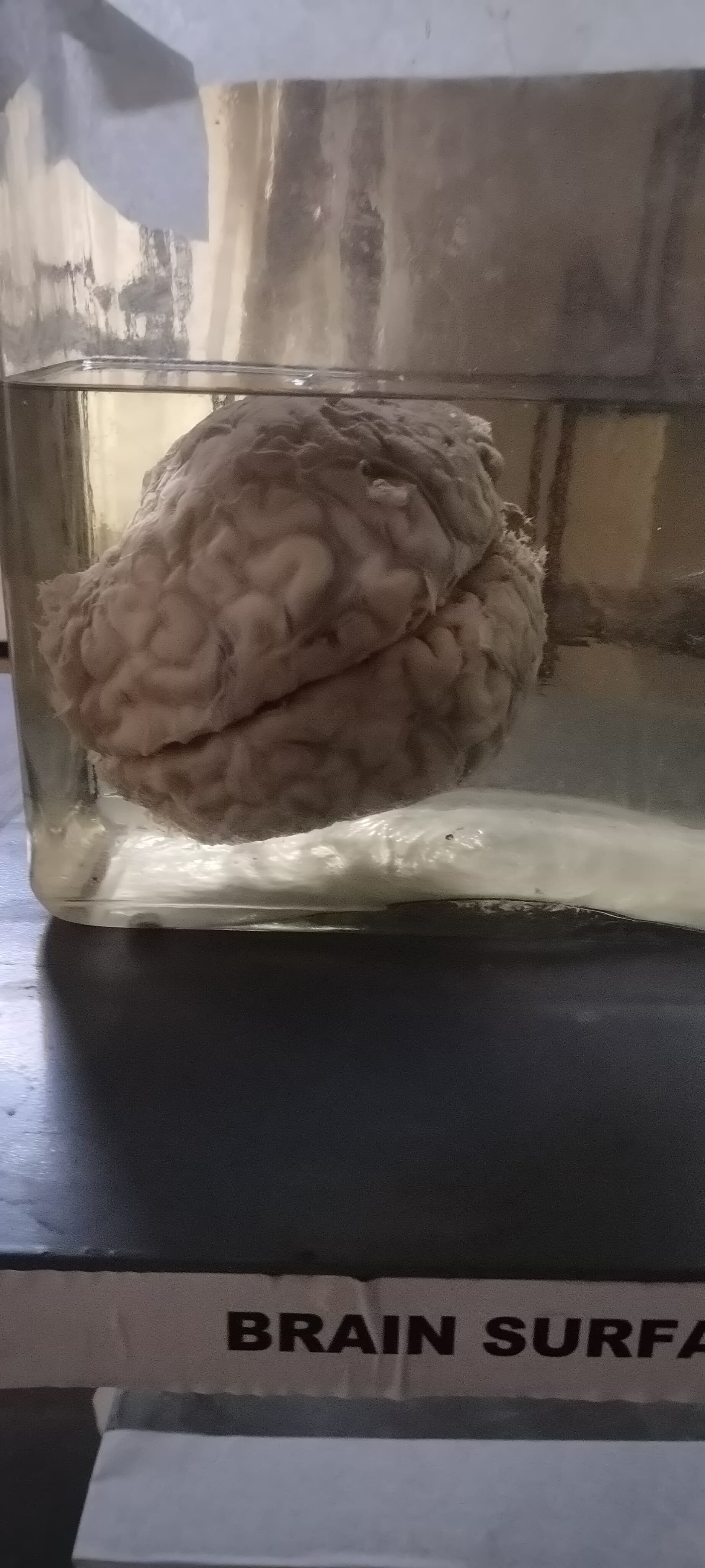 Tezpur Medical College & Hospital Facilities & Labs photo (5) by Tanvi Dhaker