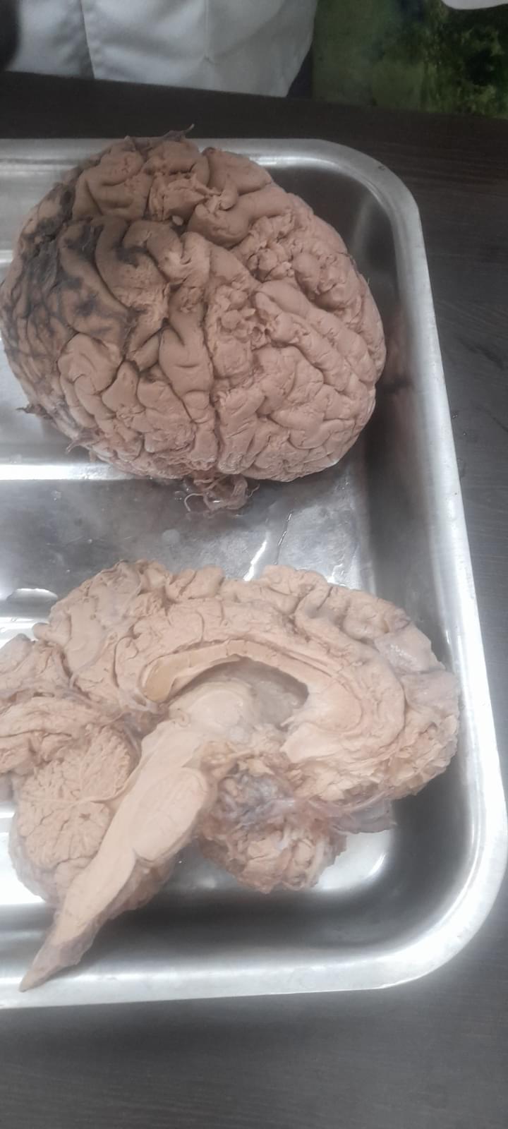 Jhargram Government Medical College Facilities & Labs photo 2